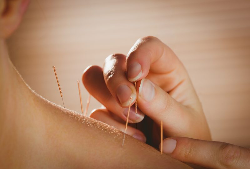 Hvor ofte skal man behandles med akupunktur